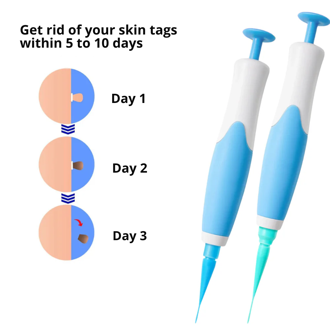 DermaEase Kit | Safely Remove Skin Tags At Home