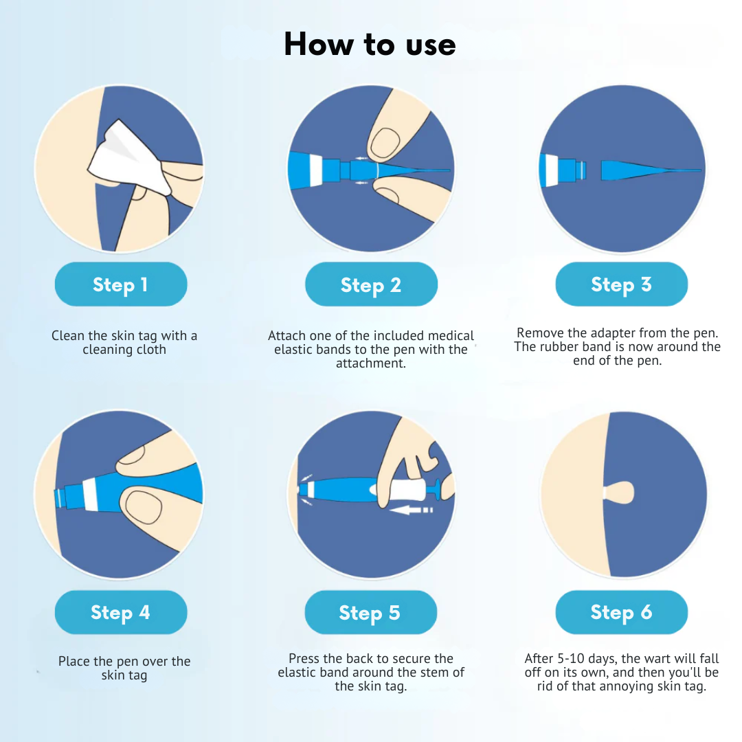 DermaEase Kit | Safely Remove Skin Tags At Home