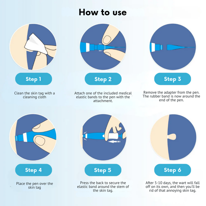DermaEase Kit | Safely Remove Skin Tags At Home